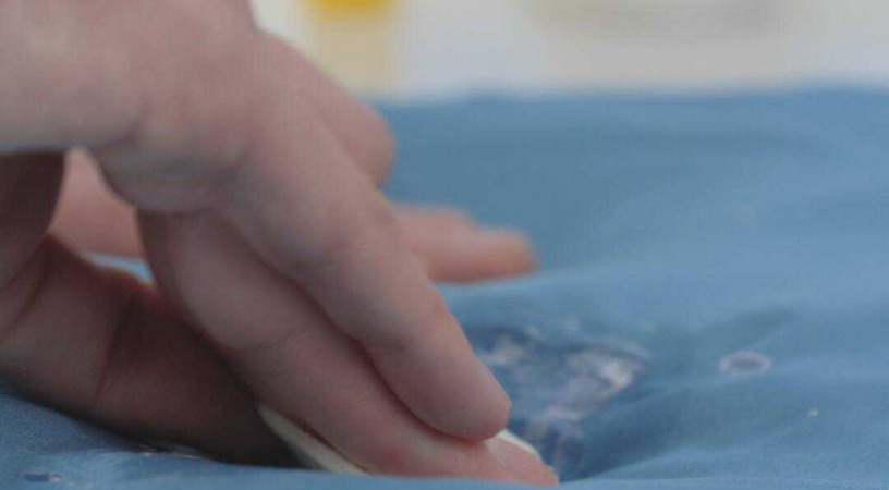 How to remove the glue from clothes?